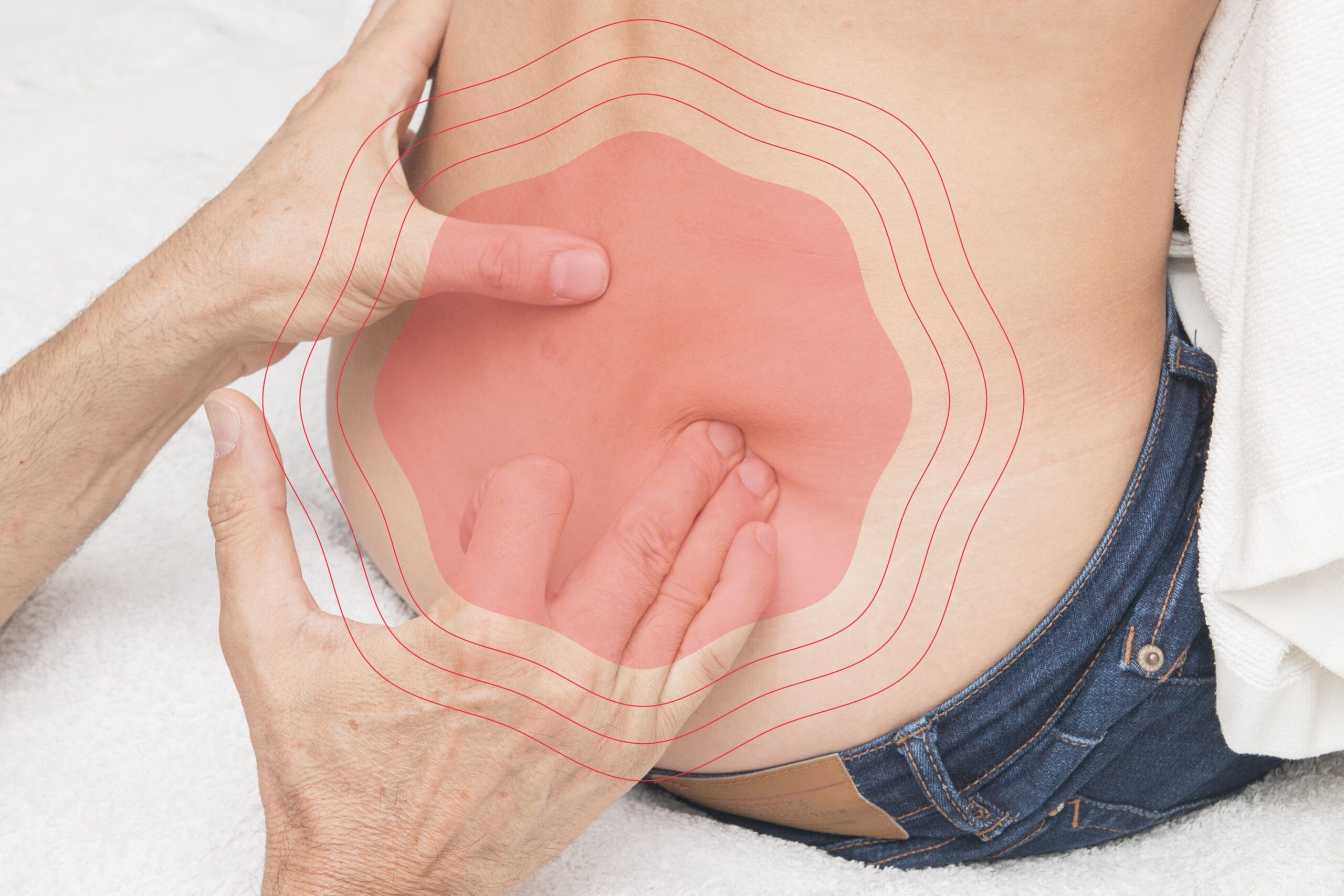 Criterios de derivación lumbalgia